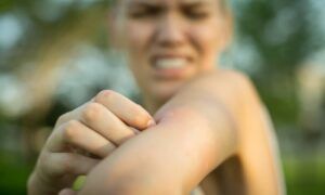 Pourquoi y a-t-il autant de moustiques dans votre jardin ? pourquoi-y-a-t-il-autant-de-moustiques-dans-votre-jardin.jpg